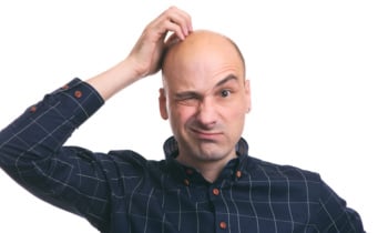 Confused bald guy scratch his head